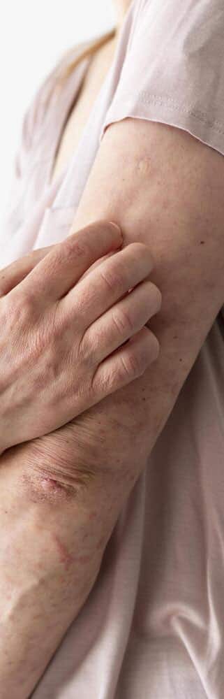 Close-up of skin with scars